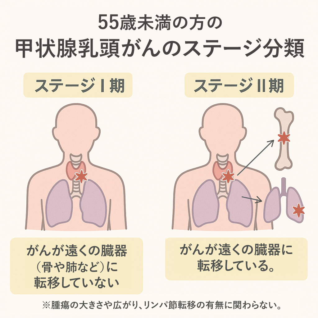 甲状腺乳頭がんステージ分類